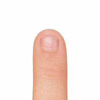 Vos ongles sont courts ou rongés